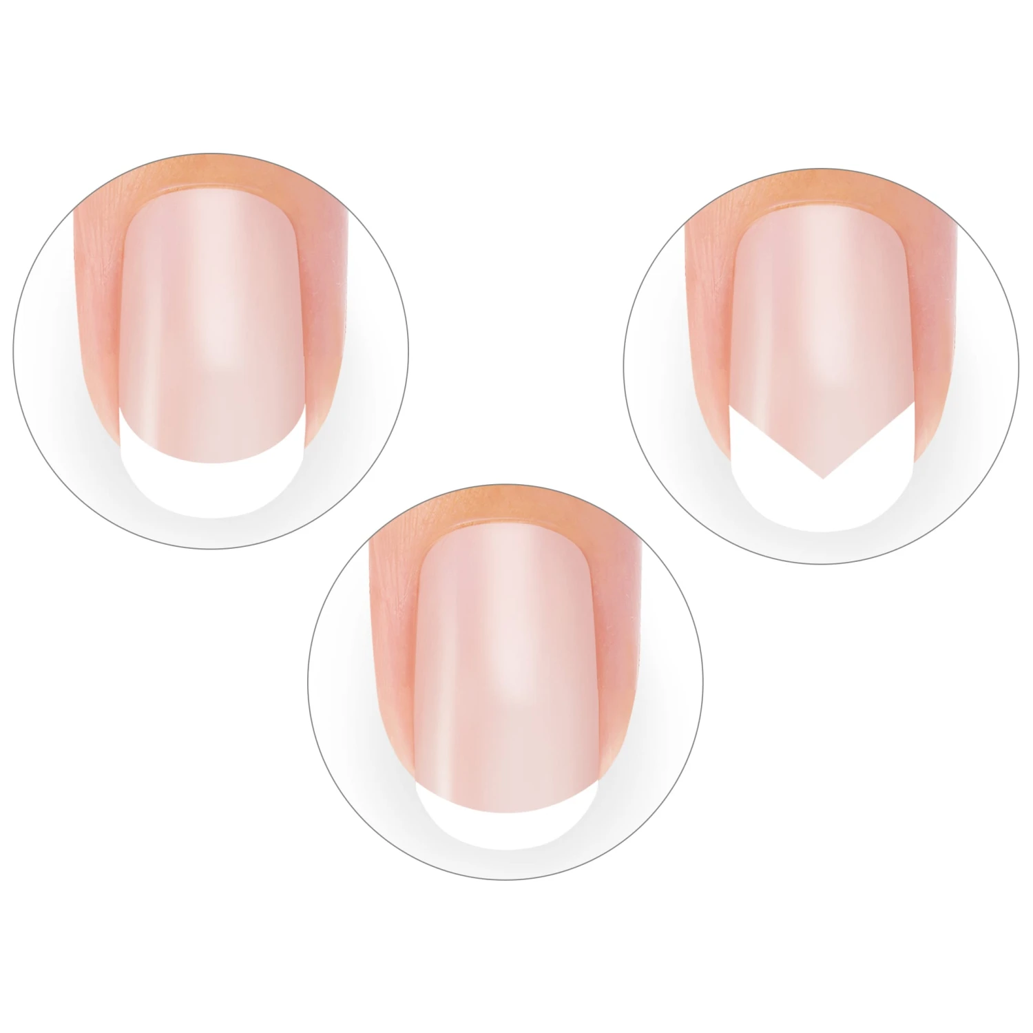 Edge Trimmer Set 5 Edge Trimmer Set – Bild 3